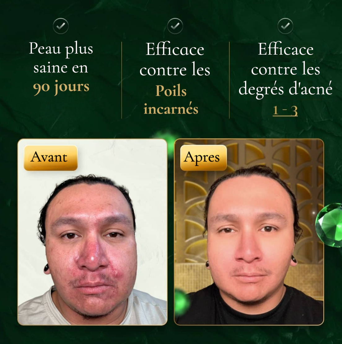 LumI™ | brosse vibrante pour le visage